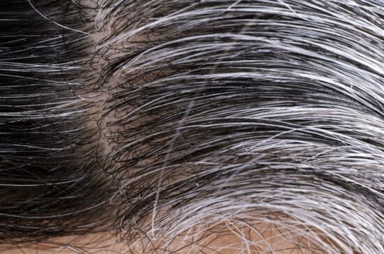 Causes of White Hair and Natural Ways to Prevent White Hair